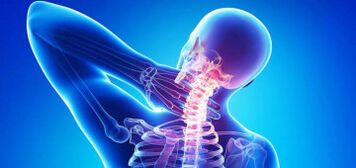 Causes de l'ostéochondose cervicale