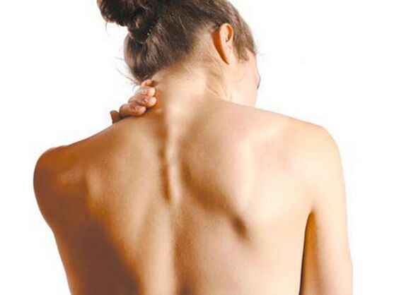 La jeune fille souffre d'ostéochondrose cervicale