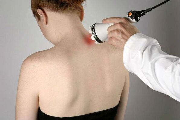mesures physiothérapeutiques pour le traitement de l'ostéochondrose cervicale