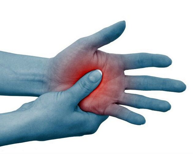 Une douleur intense dans les articulations des doigts, atténuée par l’activité physique, est un signe typique de la polyarthrite rhumatoïde.